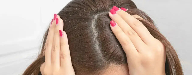 Ditch Dandruff and Flakes! Bionnex Anti Dandruff Shampoo - derma.pk | Expert Hair Care