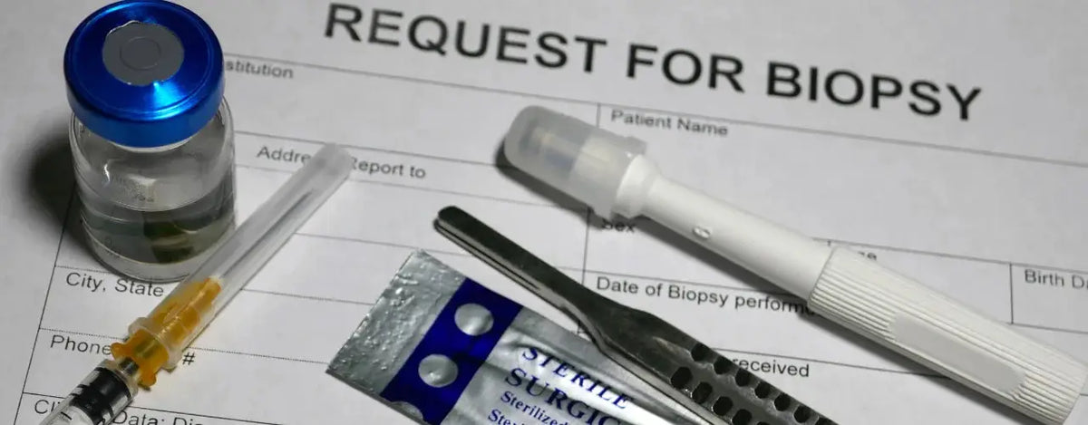 Biopsies: Unlocking the Secrets of Your Body