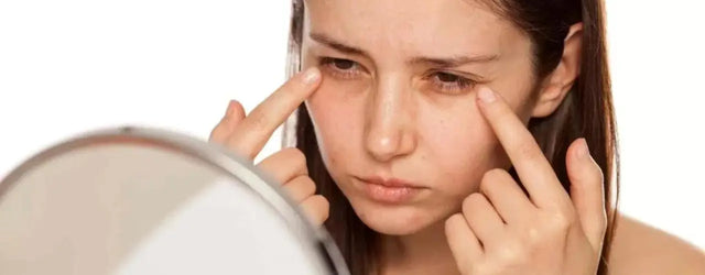 Tips for Reducing Dark Circles