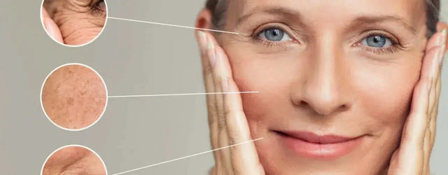 Wrinkles And Fine Lines: Management With Micro-needling And Fractional CO2