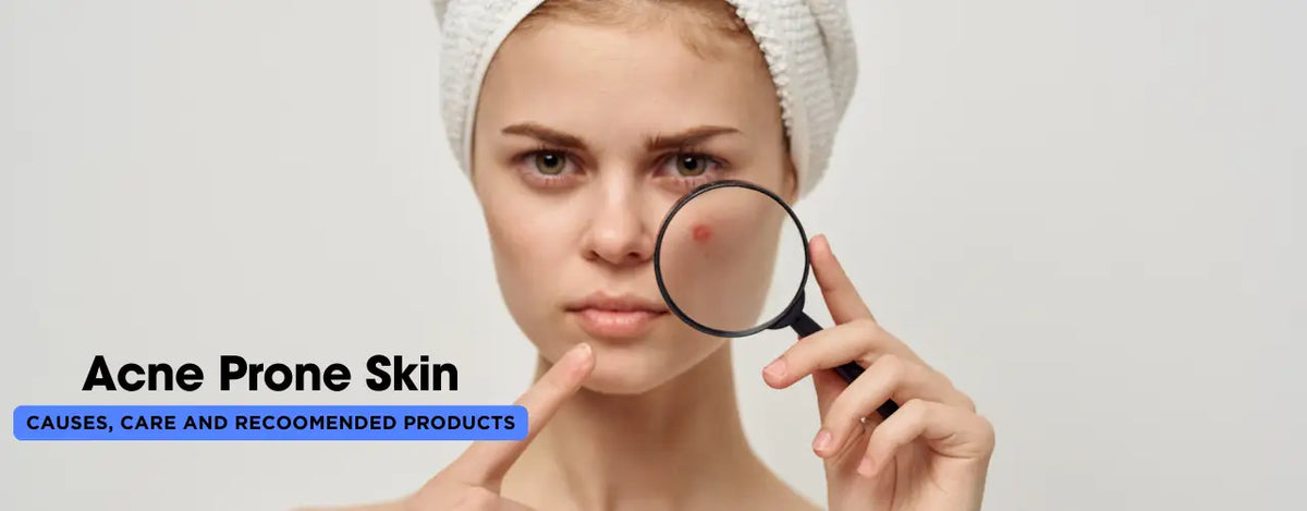 Understanding Acne-Prone Skin: Causes, Care, and Recommended Products