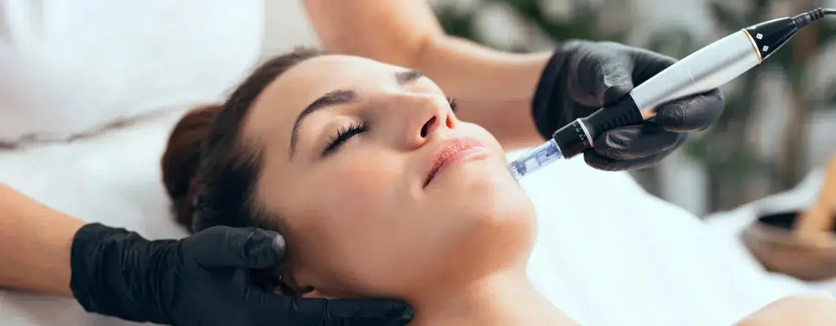 Microneedling: Revitalizing Skin Texture for a Radiant Glow