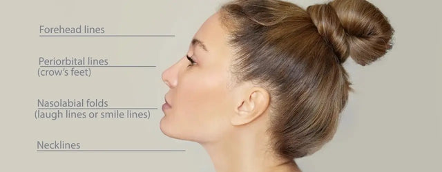 What are the fillers and post care of fillers