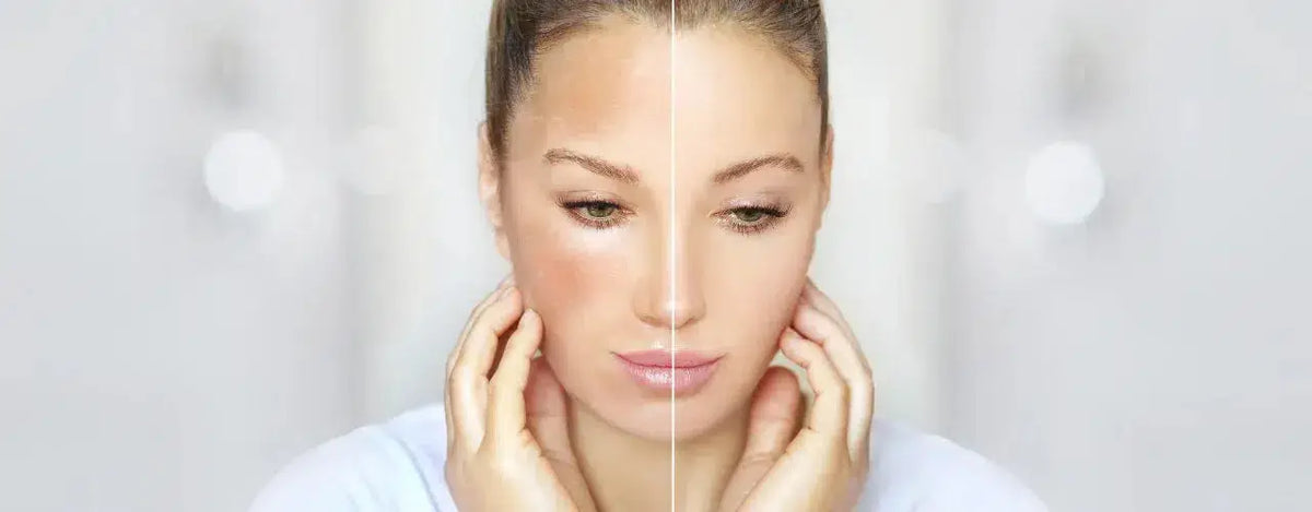 Get Brighter, Healthier, and More Radiant Skin with Glamfair Cream