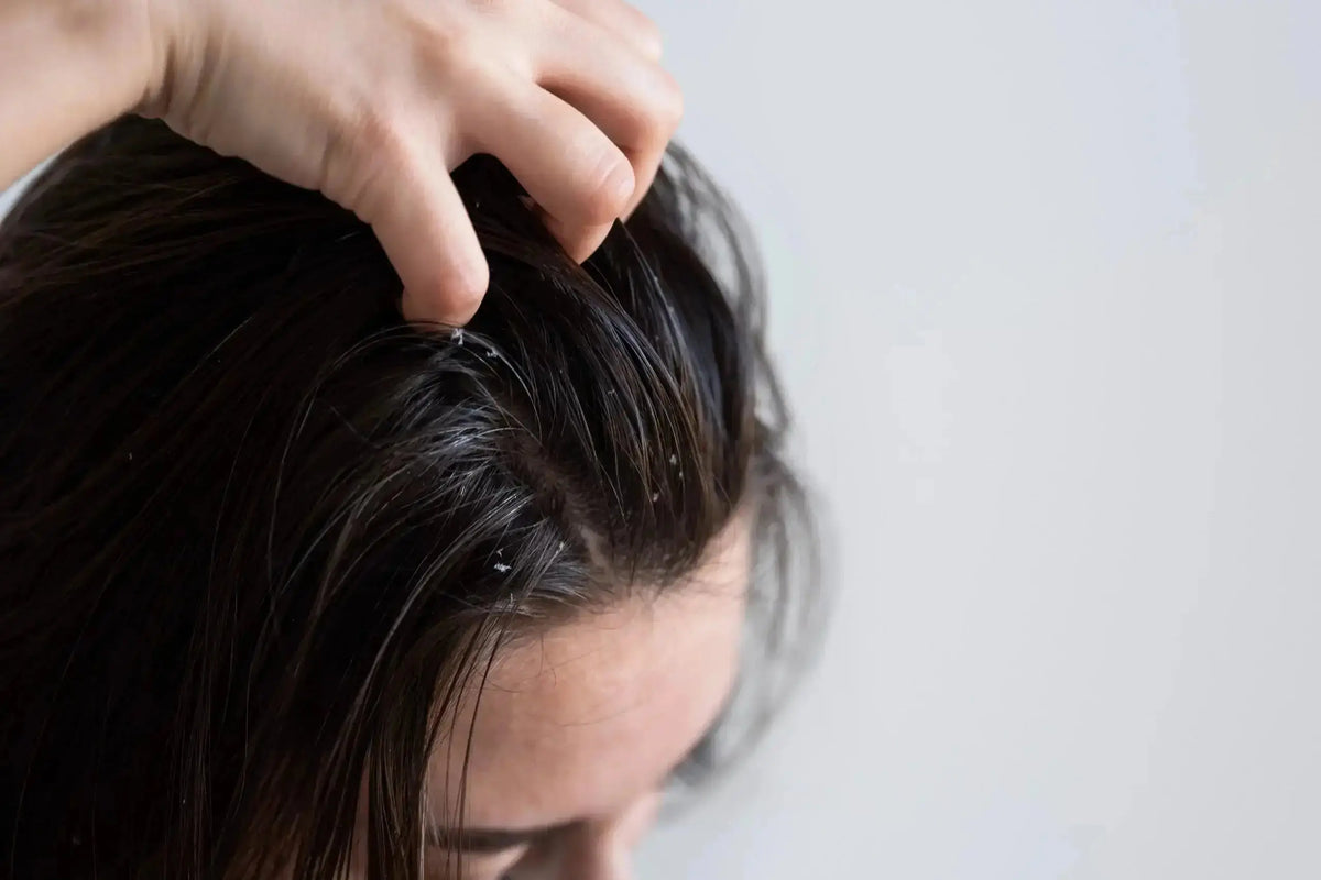 5 Benefits of Pirox Shampoo: Dandruff Solution