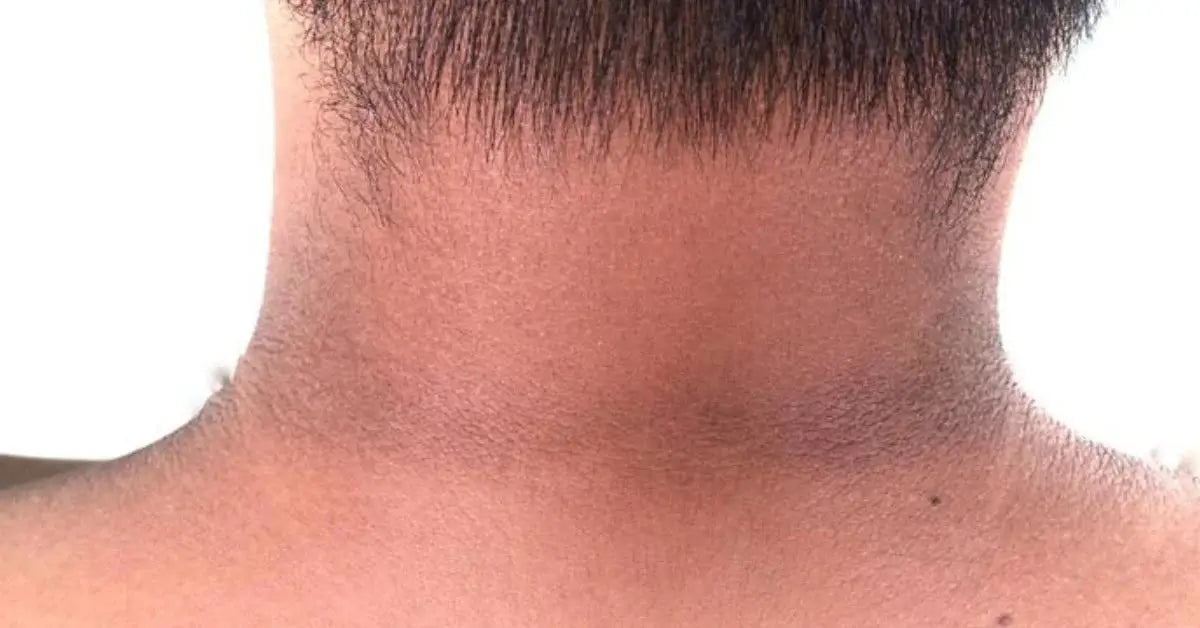 Whitening Cream for Neck: Achieve Even Skin Tone