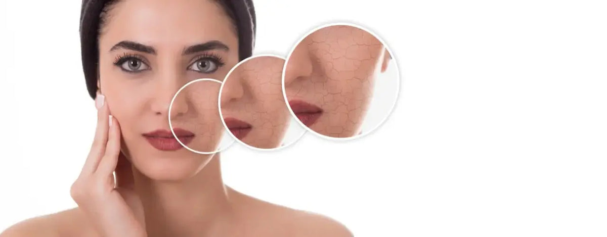 Say Goodbye to Dry Skincare in 4 Simple Steps