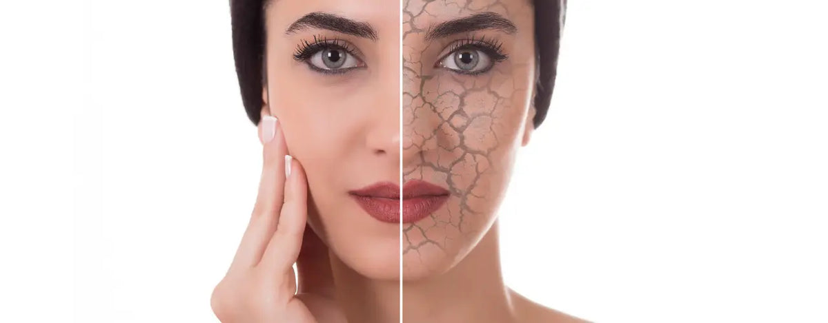 Understanding Dry Skin: Causes, Treatment, and Recommended Products