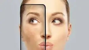 Melasma Disease: Top Causes and Effective Prevention Strategies
