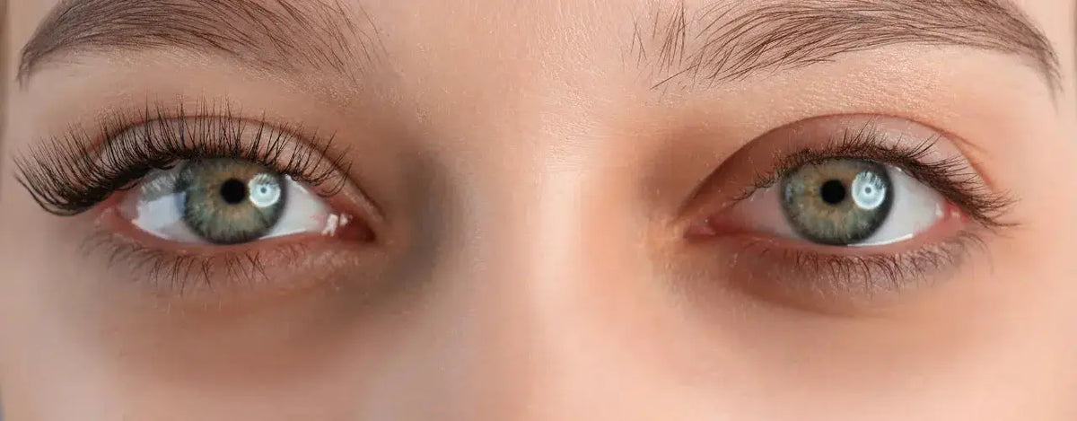 Microneedling for Dark Eye Circles: Unveiling the Secrets to Radiant Eyes