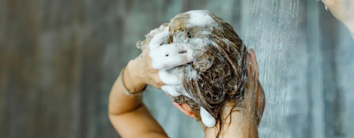 Cosalic Lotion: Your Solution for Psoriasis and Dandruff