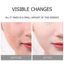 VEZE Gold Hyaluronic Acid Hydrating Face Sheet Mask 25g photo 4