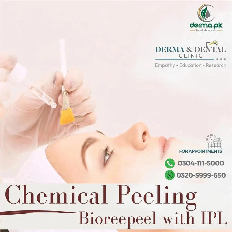Enhance Your Skin with Chemical Peeling Bioreepeel and IPL - Skin Clinic by Dr. Eram Razzaq