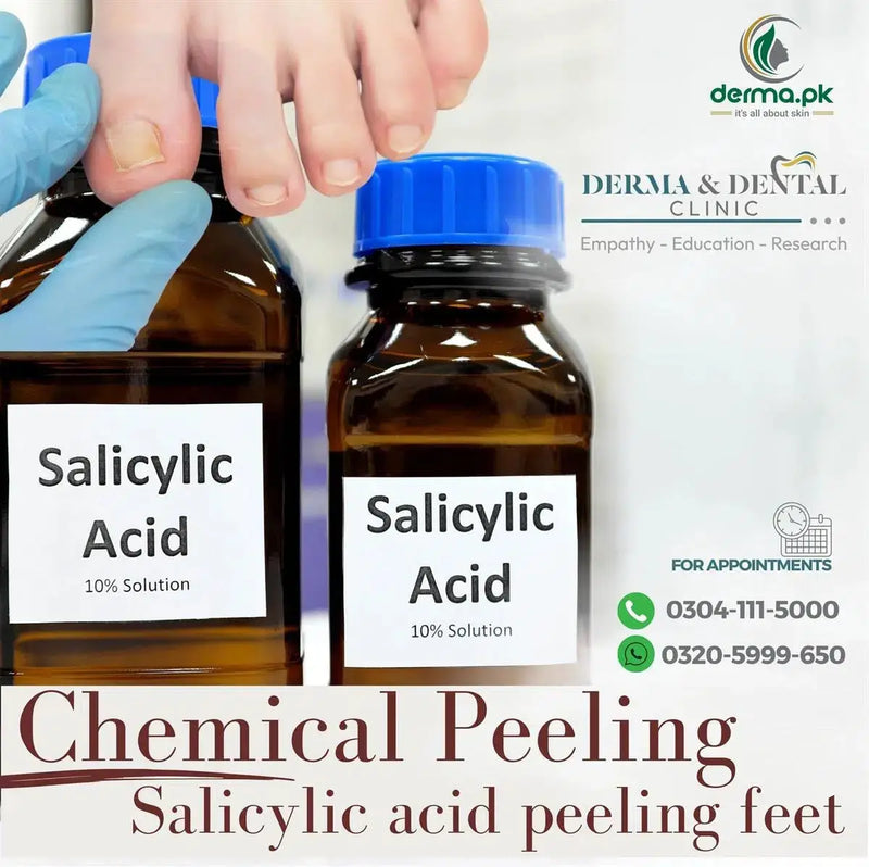 Exploring Salicylic Acid Foot Peeling: Dermatological Insights at Skin Clinic by Dr. Eram Razzaq