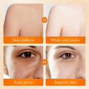 Sadoer Kojic Acid Brightening Soap - 100g photo 3