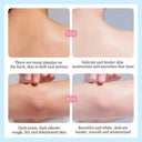 SADOER Rose Body Butter Lotion β Moisturizing & Brightening Body Cream 200g photo 5