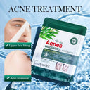 Sadoer Pack of 3 Tea Tree Oil Control Anti-Acne Series photo 3