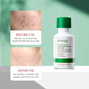 BIOAQUA Salicylic Acid Acne Removal Face Serum 35ml photo 3