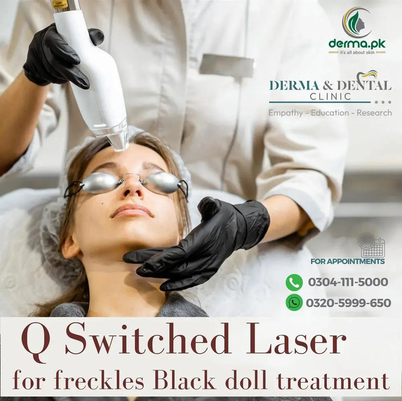 The Science of Q-Switched Laser: Advancing Freckle Treatment at Skin Clinic by Dr. Eram Razzaq