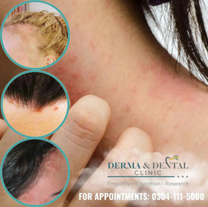 Transform Your Hair Dye Experience with Derma & Dental Clinic
