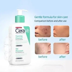 CeraVe Cleansing Gel for Oily Skin 87ml — foaming gel texture for oily and combination skin