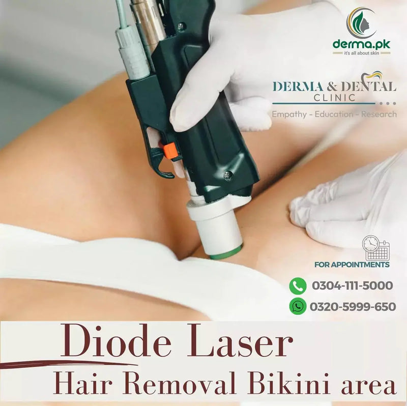 Advanced Diode Laser Hair Removal: Smooth Confidence at Skin Clinic by Dr. Eram Razzaq