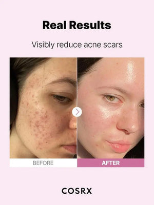 Cosrx The Niacinamide 15% Serum 20ml