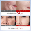 SADOER Snail Collagen Anti-Wrinkle Skincare Set - 5-Piece Firming & Moisturizing Kit photo 5