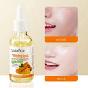 SADOER Turmeric Anti-Oxidation Face Serum - Brighten & Lighten Acne Marks - 30ml photo 7