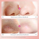 SADOER Bamboo Charcoal Deep Cleansing Nose Strips 6pcs photo 5
