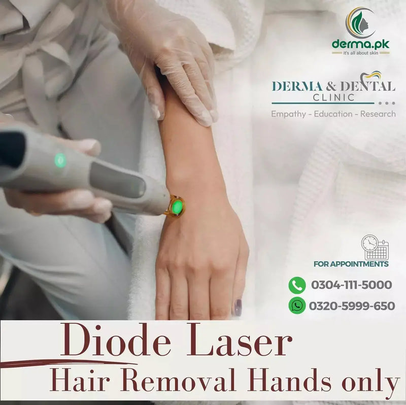 Precision Diode Laser Hair Removal for Hands: A Scientific Approach at Skin Clinic by Dr. Eram Razzaq