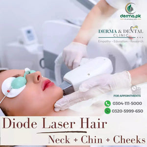 Scientific Diode Laser Hair Removal for Neck, Chin, and Cheeks – Available in Pakistan