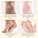 SADOER Shea Butter Anti-Cracking Hand Foot Cream 60gm photo 5