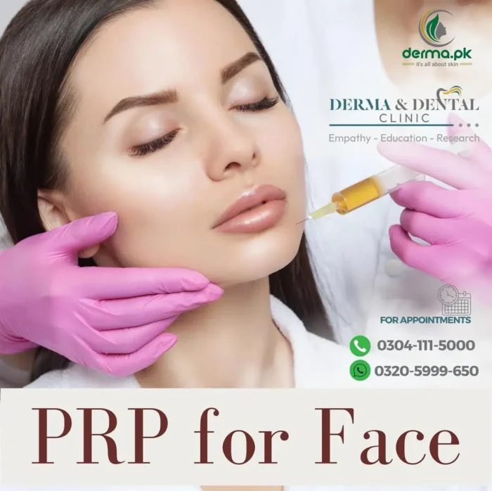 Your Health Prp Therapy At Derma Dental Clinic