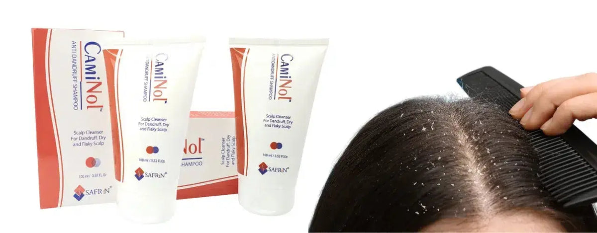 caminol anti dandruff shampoo review: Ditch the Flakes, Embrace Shine