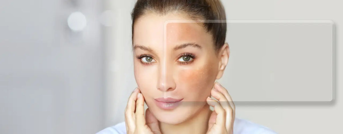 Illuminate Your Radiance with Acta White Skin Brightening Soap