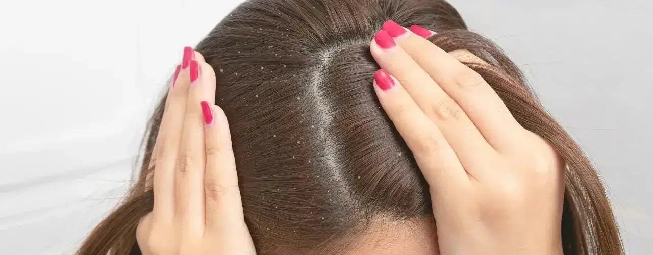 Bionnex Anti Dandruff Shampoo for dandruff and flakes treatment itchy scalp Pakistan