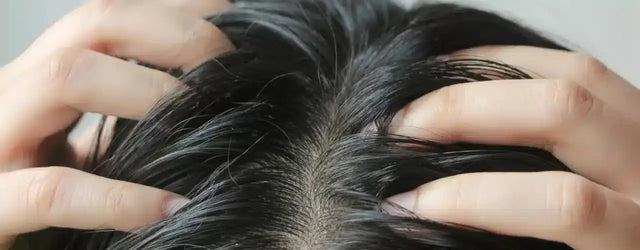 ELUTED-SA Anti Dandruff Shampoo: Eliminating Dandruff, Redness, and Itching