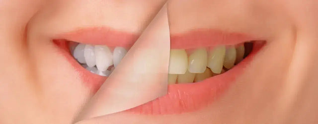 The Art and Science of Smile Design: A Dentist's Guide to Crafting Beautiful Smiles