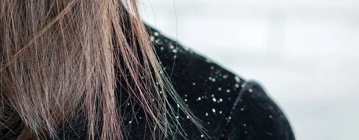 Caminol Anti Dandruff Shampoo: Your Solution for a Healthy Scalp
