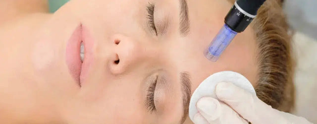 Microneedling benefits: A Promising Tool for Specific Concerns