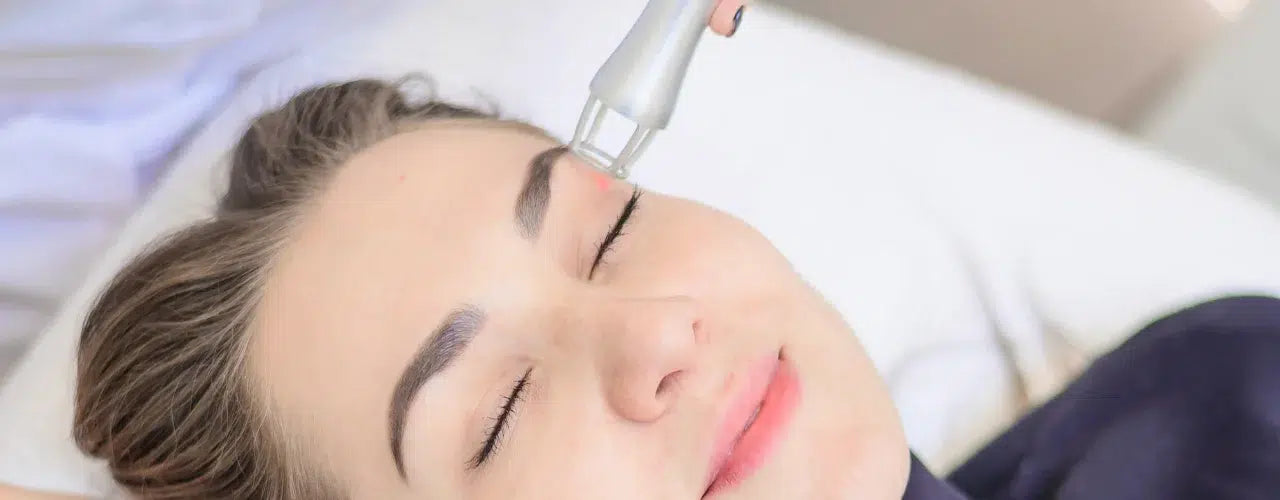 Fractional CO2 Laser