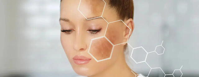 Melaneez Cream: Your Solution for Pigment Reducing Therapy