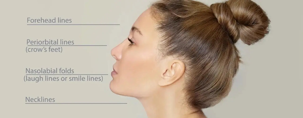 What are the fillers and post care of fillers