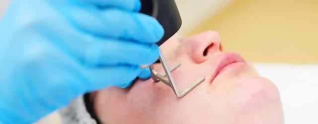 Fractional CO2 Laser For Acne Scars: Scientific Evidence