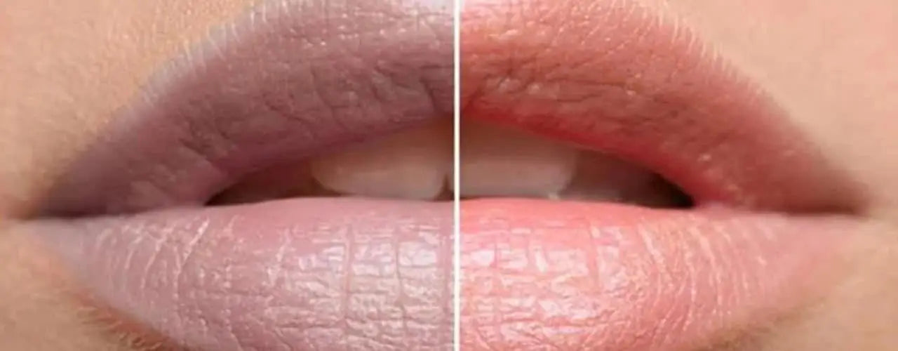 dark and pigmented lips
