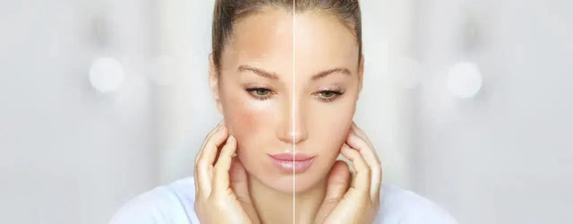Get Brighter, Healthier, and More Radiant Skin with Glamfair Cream