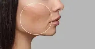Scar Treatment for Face: 7 Effective Methods to Heal and Renew Skin
