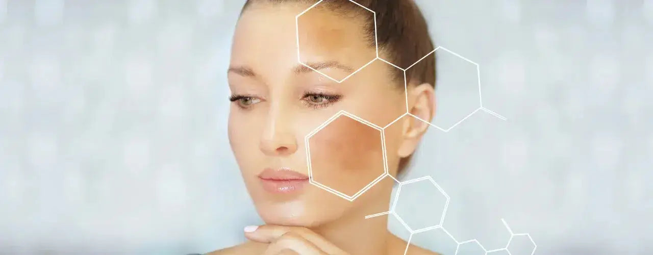 MELASCO Melasma Cream