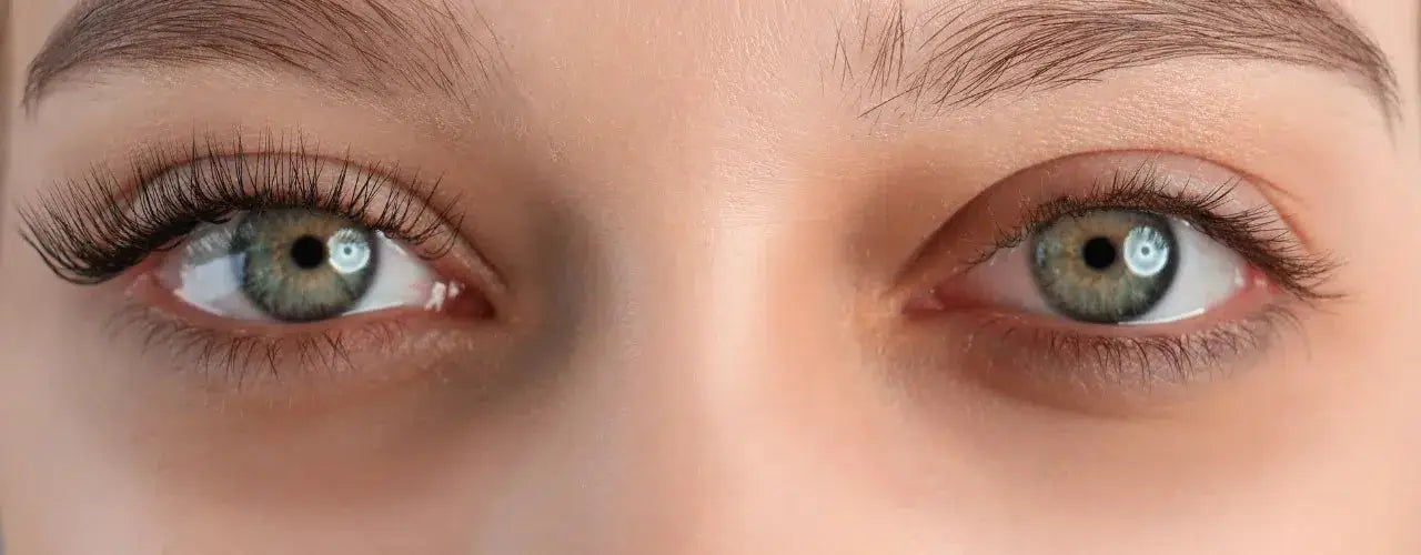 micro needling for dark eye circles